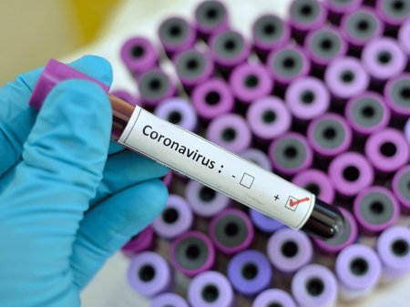 Azərbaycanda ilk koronavirus nfeksiyasına yoluxma faktının qeydə alındığı təsdiq edildi