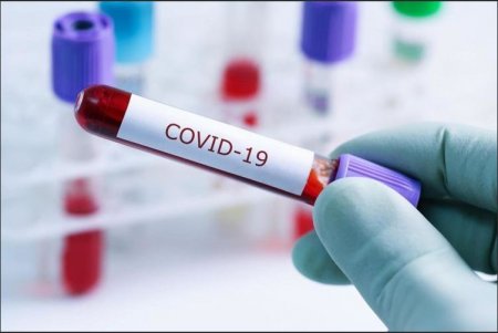 Azərbaycanda daha 77 nəfər koronavirusa yoluxdu