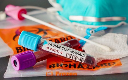 Ölkə üzrə aparılmış koronavirus testinin ümumi sayı açıqlandı