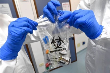 Ölkədə koronaviruslu xəstələrin sayı 21 mini keçdi