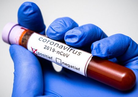 Dünyada koronavirusa yoluxanların sayı 25 milyonu ötüb