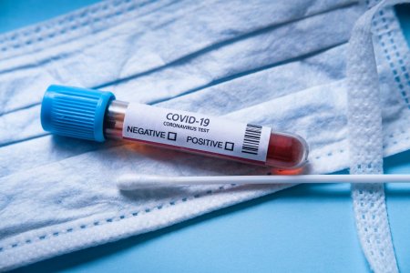 Azərbaycanda daha 2 424 nəfər koronavirusa yoluxub, 36 nəfər vəfat edib