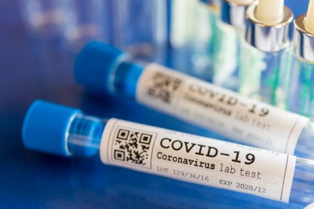 Dünyada koronavirusa 1,6 milyon insan yoluxub