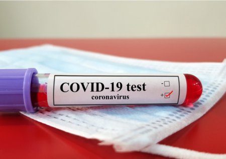 Reanimasiyada olan COVID-19 xəstələrinin sayı açıqlandı