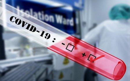 Azərbaycanda koronavirusa 146 yeni yoluxma qeydə alınıb, 1 nəfər vəfat edib