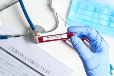 Azərbaycanda koronavirusa 153 nəfər yeni yoluxma qeydə alınıb