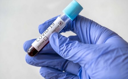 Azərbaycanda koronavirusa 147 yeni yoluxma faktı qeydə alınıb