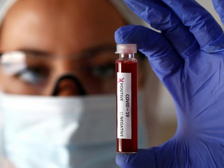Finlandiyada 45 saniyəyə koronavirusu aşkarlayan cihaz icad edilib