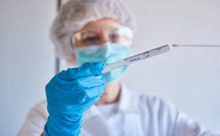 Azərbaycanda daha 126 nəfər koronavirusa yoluxub
