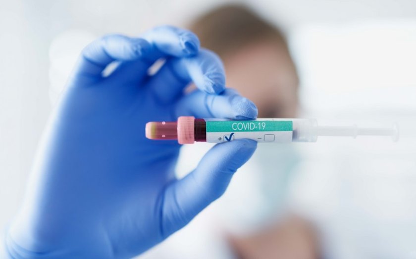 Azərbaycanda sutka ərzində 62 nəfər koronavirusa yoluxub