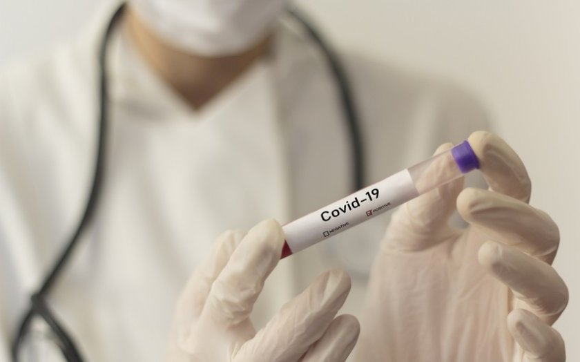 Azərbaycanda daha 80 nəfər koronavirusa yoluxub, 4 nəfər ölüb