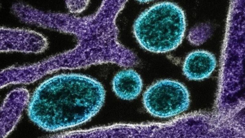 Yeni virus yayılmaqdadır
