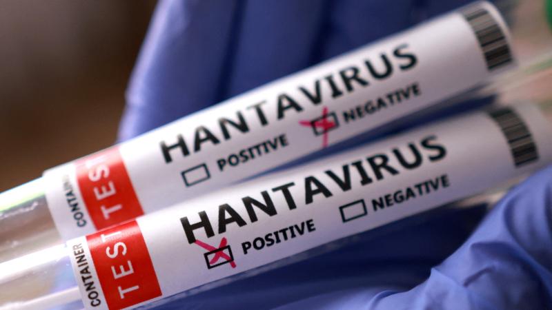 Hantavirus qlobal aləm üçün nə dərəcədə təhlükəlidir?